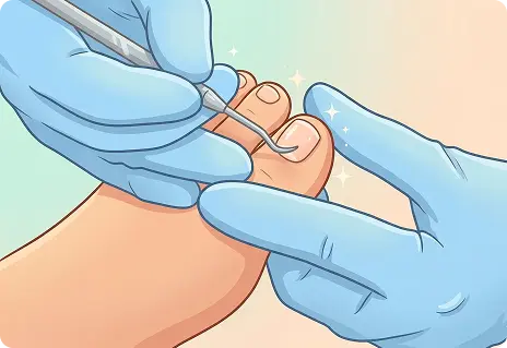 Medical Pedicure illustration